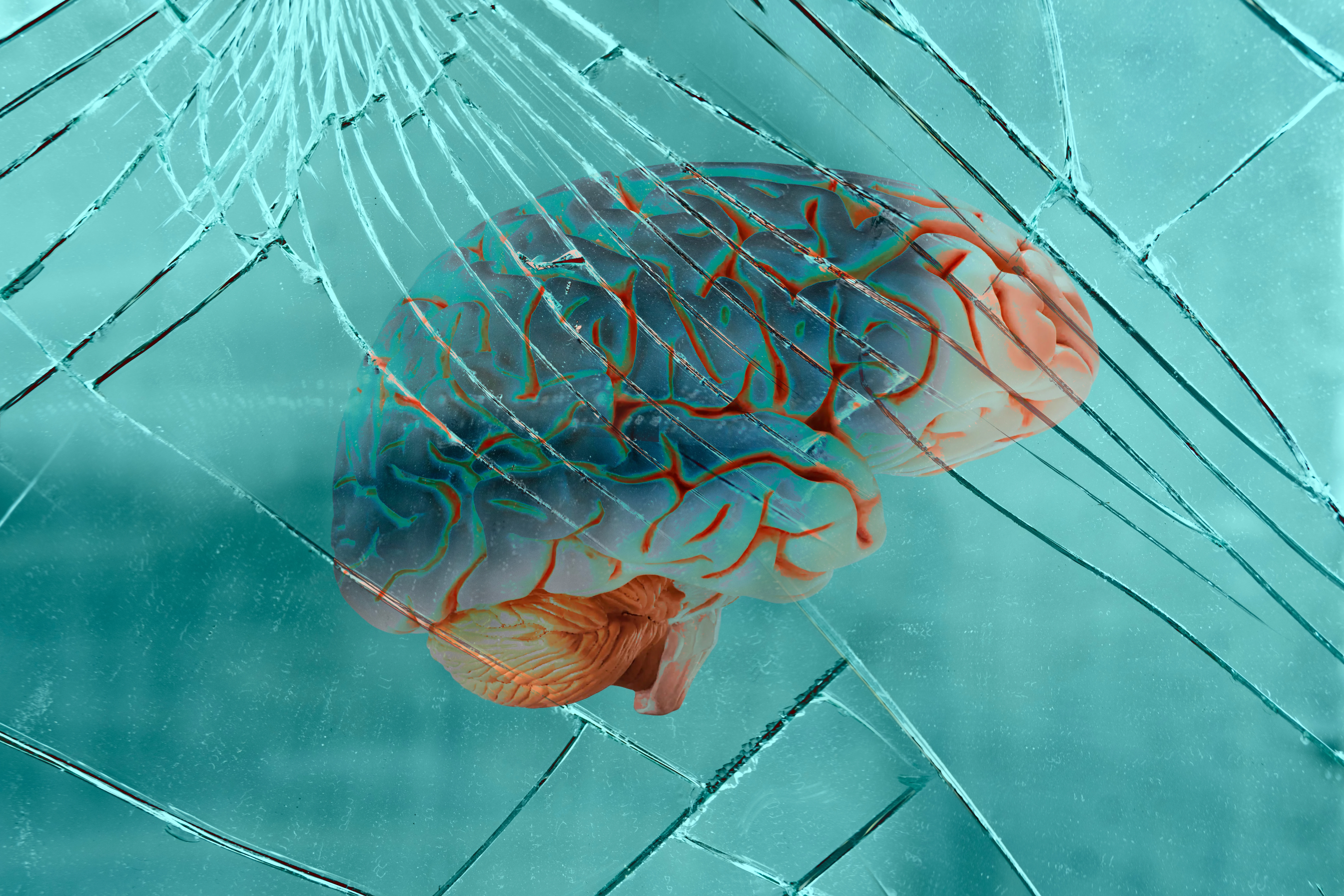 Richmond traumatic brain injury